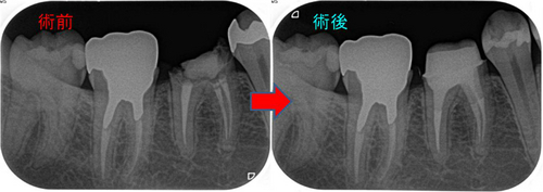 わざわざ沖縄から治療に！！ - EE DENTAL_Blog